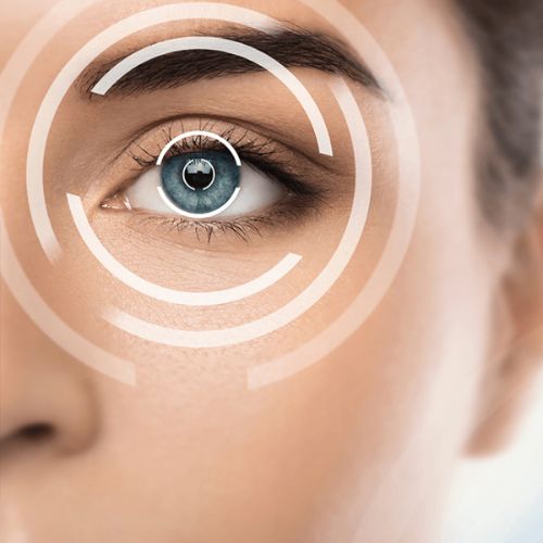 ICL (Implantable Collamer Lens)